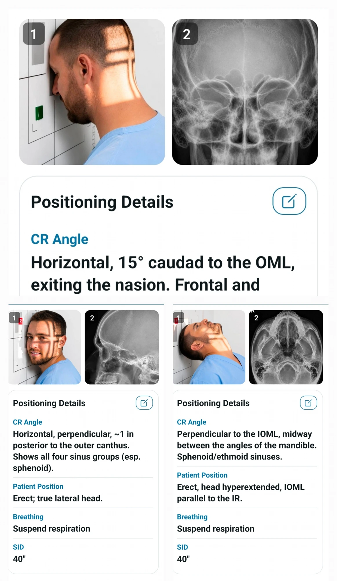 Technique & Positioning reference with patient positioning photos, X-rays and positioning details in X-Ray Vault